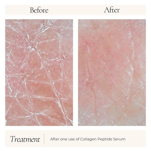 Collagen Peptide Serum