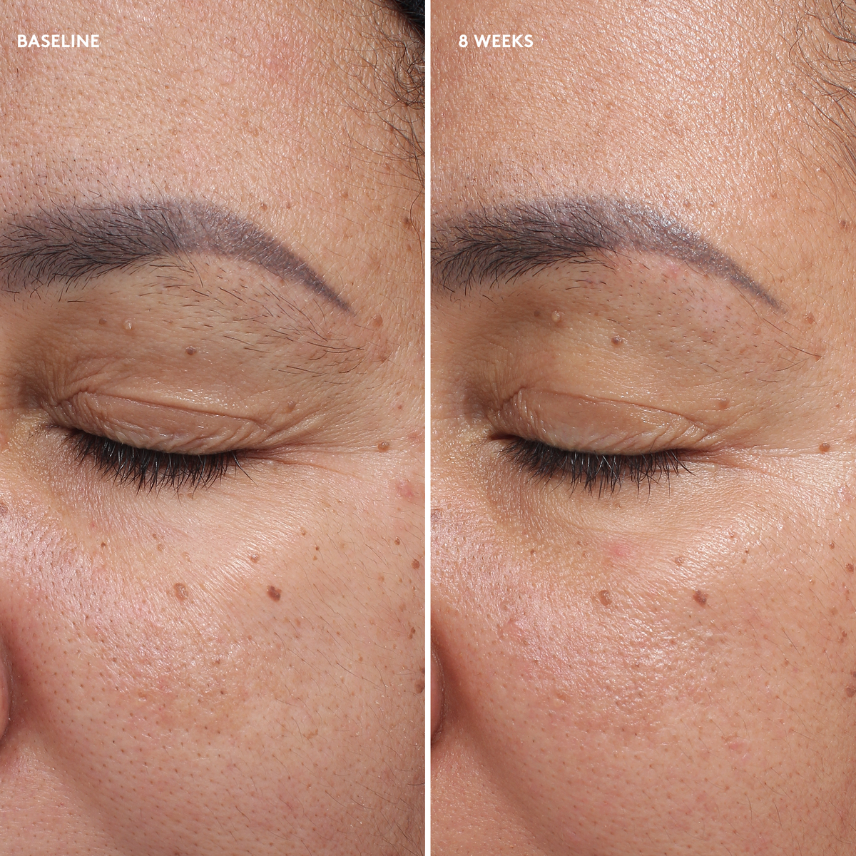 Total Eye Complex Total Eye® Firm & Repair Cream – Dr. Esti